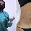 Clínica clandestina “Detox” ofrecía cirugías riesgosas y procedimientos sin aval profesional