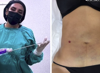 Clínica clandestina “Detox” ofrecía cirugías riesgosas y procedimientos sin aval profesional