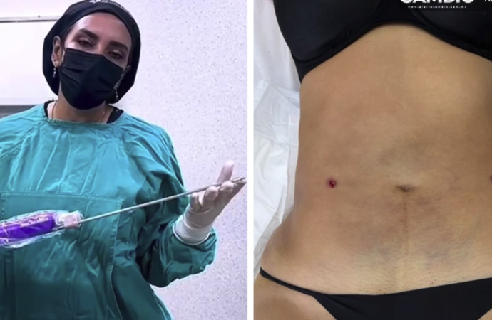 Clínica clandestina “Detox” ofrecía cirugías riesgosas y procedimientos sin aval profesional